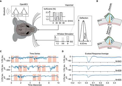 Machine learning reveals interhemispheric somatosensory coherence as indicator of anesthetic depth